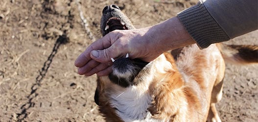 Dog Biting The Hand Of A Person In Las Vegas, NV