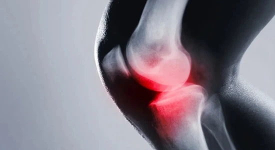 xray of inflamed joint